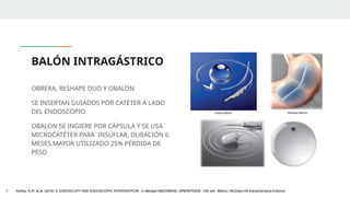 BALÓN INTRAGÁSTRICO
OBRERA, RESHAPE DUO Y OBALON
SE INSERTAN GUIADOS POR CATÉTER A LADO
DEL ENDOSCOPIO
OBALON SE INGIERE POR CÁPSULA Y SE USA
MICROCATÉTER PARA INSUFLAR, DURACIÓN 6
MESES.MAYOR UTILIZADO 25% PÉRDIDA DE
PESO
1. Ashley, S.W. et al. (2019) ‘5: ENDOSCOPY AND ENDOSCOPIC INTERVENTION’, in Maingot ABDOMINAL OPERATIONS. 13th edn. México: McGraw-Hill Interamericana Editores.
 