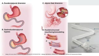 1. Ashley, S.W. et al. (2019) ‘5: ENDOSCOPY AND ENDOSCOPIC INTERVENTION’, in Maingot ABDOMINAL OPERATIONS. 13th edn. México: McGraw-Hill Interamericana Editores.
 