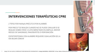 INTERVENCIONES TERAPÉUTICAS CPRE
2 TIPOS POR NAVAJA (PRECUT) O POR ALAMBRE
POR PRECUT SE REALIZA CUANDO NO SE PUEDE CANULAR O SE
REALIZA SOBRE STENT, O LITO IMPACTADO EN ÁMPULA, MAYOR
RIESGO DE SANGRADO, PANCREATITIS O PERFORACIÓN
ESFINTEROTOMIA CON ALAMBRE REQUIERE CANULACIÓN DE LA
VIA BILIAR COMUN
1. Ashley, S.W. et al. (2019) ‘5: ENDOSCOPY AND ENDOSCOPIC INTERVENTION’, in Maingot ABDOMINAL OPERATIONS. 13th edn. México: McGraw-Hill Interamericana Editores.
 