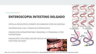 ENTEROSCOPIA INTESTINO DELGADO
CÁPSULA ENDOSCÓPICA PERMITE VER IMÁGENES PERO NO BIOPSIAS
ENTEROSCOPIA PUSH Y SONDA DE ENTEROSCOPIA
ENDOSCOPIA INTRAOPERATORIA TRANSORAL O TRANSANAL O POR
ENTEROTOMIA
ENDOSCOPIO CON DOBLE BALÓN FACILITA VALORACION DE
INTESTINO DELGADO
1. Ashley, S.W. et al. (2019) ‘5: ENDOSCOPY AND ENDOSCOPIC INTERVENTION’, in Maingot ABDOMINAL OPERATIONS. 13th edn. México: McGraw-Hill Interamericana Editores.
 