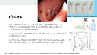 TÉCNICA
POR TORTUOSIDAD Y FALTA DE FIJACIÓN SE REQUIERE REALIZAR
TORQUE Y REDUCCIÓN DE ASAS, MOVILIZACIÓN DEL PACIENTE Y
COMPRESIÓN ABDOMINAL MANUAL.
POCA RELACIÓN ENTRE LONGITUD DEL TUBO INSERTADO Y POSICIÓN
ANATÓMICA ACTUAL
TACTO RECTAL PREVIO, SE INSERTA TUBO Y SE INSUFLA EVALUANDO
MUCOSA, SE AVANZA Y EN CASO DE RED OUT SE RETIRA UN POCO,
1. Ashley, S.W. et al. (2019) ‘5: ENDOSCOPY AND ENDOSCOPIC INTERVENTION’, in Maingot ABDOMINAL OPERATIONS. 13th edn. México: McGraw-Hill Interamericana Editores.
 