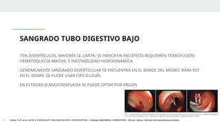 SANGRADO TUBO DIGESTIVO BAJO
75% DIVERTÍCULOS, MAYORÍA SE LIMITA, SE INDICA EN PACIENTES REQUIEREN TRANSFUSIÓN,
HEMATOQUECIA MASIVA, E INESTABILIDAD HEMODINÁMICA.
GENERALMENTE SANGRADO DIVERTICULAR SE ENCUENTRA EN EL BORDE DEL MISMO, RARA VEZ
EN EL DOMO, SE PUEDE USAR CIPS O LIGAS.
EN ECTASIAS O ANGIODISPLASIA SE PUEDE OPTAR POR ARGÓN
1. Ashley, S.W. et al. (2019) ‘5: ENDOSCOPY AND ENDOSCOPIC INTERVENTION’, in Maingot ABDOMINAL OPERATIONS. 13th edn. México: McGraw-Hill Interamericana Editores.
 