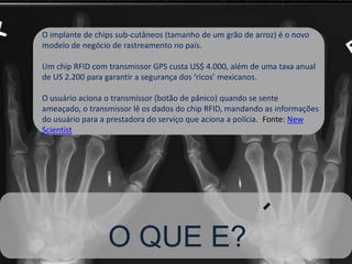 Rapidez da evolução tecnológica X Tempo de assimilação do indivíduoIntervalo relâmpago de surgimento de outras formas de armazenamento    - My Click    - My Shot