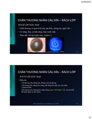 12/28/2015
13
CHẤN THƯƠNG NHÃN CẦU KÍN – RÁCH LỚP
RÁCH LỚP GIÁC MẠC
• Chấn thương va quẹt từ lá cây, hạt thóc, móng tay, ngòi viết …
• Cơ năng: đau, sợ ánh sáng, chảy nước mắt.
• Thực thể: vết rách giác mạc, seidel (-)
ThS.BS. Trần Đình Minh Huy - Bộ môn Mắt Đại Học Y Dược TP.HCM 25
CHẤN THƯƠNG NHÃN CẦU KÍN – RÁCH LỚP
RÁCH LỚP GIÁC MẠC
• Điều trị:
• Vết thương nhỏ, đóng kín: kháng sinh dự phòng.
• Vết thương lớn, đóng kín: băng mắt bằng kín tiếp xúc, keo dính
cyanoacrylate.
• Vết thương lớn, không kín: khâu bằng nylon 10-0 hoặc 11-0, vùi nút thắt
để giảm nguy cơ tân mạch.
ThS.BS. Trần Đình Minh Huy - Bộ môn Mắt Đại Học Y Dược TP.HCM 26
 