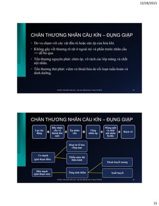 12/28/2015
15
CHẤN THƯƠNG NHÃN CẦU KÍN – ĐỤNG GIẬP
• Do va chạm với các vật đầu tù hoặc sức ép của hỏa khí.
• Không gây vết thương rõ rệt ở ngoài mi và phần trước nhãn cầu
=> dễ bỏ qua
• Tổn thương nguyên phát: chèn ép, vỡ rách các lớp màng và chất
nội nhãn.
• Tổn thương thứ phát: viêm và thoái hóa do rối loạn tuần hoàn và
dinh dưỡng.
ThS.BS. Trần Đình Minh Huy - Bộ môn Mắt Đại Học Y Dược TP.HCM 29
CHẤN THƯƠNG NHÃN CẦU KÍN – ĐỤNG GIẬP
Lực tác
động
Đẩy nhãn
cầu về
thành hốc
mắt
Ép nhãn
cầu
Tăng
nhãn áp
Màng mắt
và chất
nội nhãn
bị đẩy
Rách vỡ
Co mạch
(giai đoạn đầu)
Hoại tử tế bào
võng mạc
Thiếu máu thị
thần kinh
Dãn mạch
(giai đoạn sau)
Tăng tính thấm
Thoát huyết tương
Xuất huyết
ThS.BS. Trần Đình Minh Huy - Bộ môn Mắt Đại Học Y Dược TP.HCM 30
 