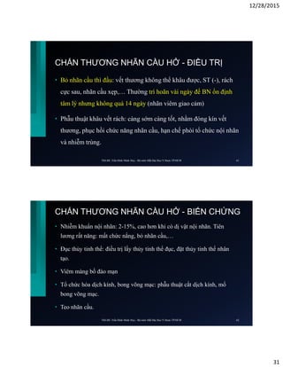 12/28/2015
31
CHẤN THƯƠNG NHÃN CẦU HỞ - ĐIỀU TRỊ
• Bỏ nhãn cầu thì đầu: vết thương không thể khâu được, ST (-), rách
cực sau, nhãn cầu xẹp,… Thường trì hoãn vài ngày để BN ổn định
tâm lý nhưng không quá 14 ngày (nhãn viêm giao cảm)
• Phẫu thuật khâu vết rách: càng sớm càng tốt, nhằm đóng kín vết
thương, phục hồi chức năng nhãn cầu, hạn chế phòi tổ chức nội nhãn
và nhiễm trùng.
ThS.BS. Trần Đình Minh Huy - Bộ môn Mắt Đại Học Y Dược TP.HCM 61
CHẤN THƯƠNG NHÃN CẦU HỞ - BIẾN CHỨNG
• Nhiễm khuẩn nội nhãn: 2-15%, cao hơn khi có dị vật nội nhãn. Tiên
lương rất năng: mất chức nắng, bỏ nhãn cầu,…
• Đục thủy tinh thể: điều trị lấy thủy tinh thể đục, đặt thủy tinh thể nhân
tạo.
• Viêm màng bồ đào mạn
• Tổ chức hóa dịch kính, bong võng mạc: phẫu thuật cắt dịch kính, mổ
bong võng mạc.
• Teo nhãn cầu.
ThS.BS. Trần Đình Minh Huy - Bộ môn Mắt Đại Học Y Dược TP.HCM 62
 