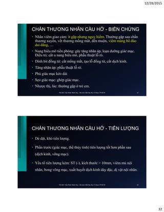 12/28/2015
32
CHẤN THƯƠNG NHÃN CẦU HỞ - BIẾN CHỨNG
• Nhãn viêm giao cảm: ít gặp nhưng nguy hiểm. Thường gặp sau chấn
thương xuyên, vết thương mống mắt, đến muộn, viêm màng bồ đào
dai dẳng, …
• Nang biểu mô tiền phòng: gây tăng nhãn áp, loạn dưỡng giác mạc.
Điều trị: cắt u nang biểu mô, phẫu thuật lỗ rò.
• Dính bít đồng tử: cắt mống mắt, tạo lỗ đồng tử, cắt dịch kính.
• Tăng nhãn áp: phẫu thuật lỗ rò.
• Phù giác mạc kéo dài
• Sẹo giác mạc: ghép giác mạc.
• Nhược thị, lác: thường gặp ở trẻ em.
ThS.BS. Trần Đình Minh Huy - Bộ môn Mắt Đại Học Y Dược TP.HCM 63
CHẤN THƯƠNG NHÃN CẦU HỞ - TIÊN LƯỢNG
• Dè dặt, khó tiên lượng.
• Phần trước (giác mạc, thể thủy tinh) tiên lượng tốt hơn phần sau
(dịch kính, võng mạc).
• Yếu tố tiên lượng kém: ST (-), kích thước > 10mm, viêm mủ nội
nhãn, bong võng mạc, xuất huyết dịch kính dày đặc, dị vật nội nhãn.
ThS.BS. Trần Đình Minh Huy - Bộ môn Mắt Đại Học Y Dược TP.HCM 64
 