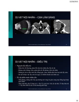 12/28/2015
35
DỊ VẬT NỘI NHÃN – CẬN LÂM SÀNG
ThS.BS. Trần Đình Minh Huy - Bộ môn Mắt Đại Học Y Dược TP.HCM 69
DỊ VẬT NỘI NHÃN – ĐIỀU TRỊ
• Nguyên tắc điều trị:
• Khâu kín vết thương, phục hồi cấu trúc nhãn cầu, lấy dị vật.
• Kháng sinh, kháng viêm, giảm phù nề, đề phòng viêm nội nhãn.
• Những dị vật có độc tính (sắt, đồng) gây viêm, nhiễm độc kim loại nên lấy sớm.
• Dị vật là thực vật: lấy sớm do nguy cơ nhiễm khuẩn nội nhãn cao.
• Dị vật phần trước nhãn cầu:
• Tiền phòng, mống mắt: lấy qua đường mở vùng rìa giác-củng mạc bằng kẹp hoặc
nam châm.
• Thủy tinh thể: nếu T3 đục/vỡ => lấy T3 và dị vật 1 thì; dị vật nhỏ, T3 đục khu trú
=> tùy bản chất dị vật và tổn thương phối hợp.
ThS.BS. Trần Đình Minh Huy - Bộ môn Mắt Đại Học Y Dược TP.HCM 70
 