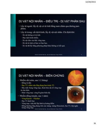 12/28/2015
36
DỊ VẬT NỘI NHÃN – ĐIỀU TRỊ - DỊ VẬT PHẦN SAU
• Lấy từ ngoài: lấy dị vật có từ tính bằng nam châm qua đường pars
plana.
• Lấy từ trong: cắt dịch kính, lấy dị vật nội nhãn. Chỉ định khi:
• Dị vật không có từ tính
• Đục dịch kính nhiều.
• Dị vật cắm vào hắc võng mạc.
• Dị vật từ tính có bao xơ bao bọc.
• Dị vật đã lấy bằng phương pháp khác không có kết quả.
ThS.BS. Trần Đình Minh Huy - Bộ môn Mắt Đại Học Y Dược TP.HCM 71
DỊ VẬT NỘI NHÃN – BIẾN CHỨNG
• Nhiễm sắt (sớm, sau 1-2 tháng)
• Đồng tử dãn
• Đục T3: chấm nâu lắng đọng bao trước T3.
• Đáy mắt: bong võng mạc, thoái hóa sắc tố võng mạc
từ chu biên.
• Điện võng mạc: sóng B giảm biên độ.
• Nhiễm đồng (muộn, sau 1 năm)
• Vòng Kayser – Fleisher
• Đục T3 dưới bao
• Võng mạc: tinh thể lấp lánh tụ hoàng điểm
• Đồng thường lắng đọng trên các màng: màng Descemet, bao T3, lớp ngăn
trong võng mạc.
ThS.BS. Trần Đình Minh Huy - Bộ môn Mắt Đại Học Y Dược TP.HCM 72
 