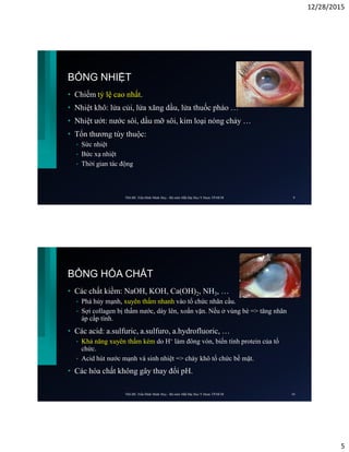 12/28/2015
5
BỎNG NHIỆT
• Chiếm tỷ lệ cao nhất.
• Nhiệt khô: lửa củi, lửa xăng dầu, lửa thuốc pháo …
• Nhiệt ướt: nước sôi, dầu mỡ sôi, kim loại nóng chảy …
• Tổn thương tùy thuộc:
• Sức nhiệt
• Bức xạ nhiệt
• Thời gian tác động
ThS.BS. Trần Đình Minh Huy - Bộ môn Mắt Đại Học Y Dược TP.HCM 9
BỎNG HÓA CHẤT
• Các chất kiềm: NaOH, KOH, Ca(OH)2, NH3, …
• Phá hủy mạnh, xuyên thấm nhanh vào tổ chức nhãn cầu.
• Sợi collagen bị thấm nước, dày lên, xoắn vặn. Nếu ở vùng bè => tăng nhãn
áp cấp tính.
• Các acid: a.sulfuric, a.sulfuro, a.hydrofluoric, …
• Khả năng xuyên thấm kém do H+ làm đông vón, biến tính protein của tổ
chức.
• Acid hút nước mạnh và sinh nhiệt => cháy khô tổ chức bề mặt.
• Các hóa chất không gây thay đổi pH.
ThS.BS. Trần Đình Minh Huy - Bộ môn Mắt Đại Học Y Dược TP.HCM 10
 