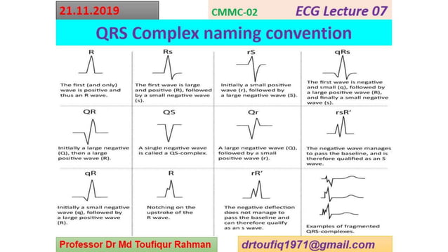 ECG -QRS complex | PPTX | Heart and Cardiovascular Diseases | Diseases ...