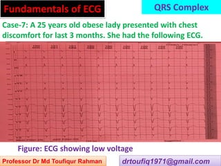 Approach to a patient with QRS complex abnormality in ECG | PPSX