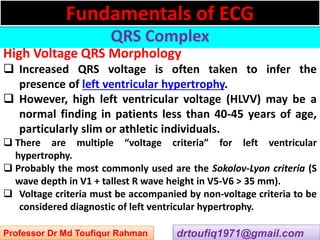 Approach to a patient with QRS complex abnormality in ECG | PPSX