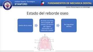 Estado del reborde oseo
Centro de la cresta
Se traza una línea
de la cúspide del
canino y el centro
del trígono
retromolar y el
tubérculo maxilar
No lingualizar
dientes
 