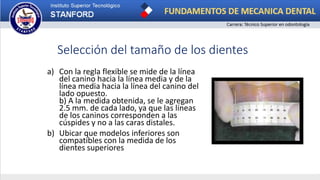 a) Con la regla flexible se mide de la línea
del canino hacia la línea media y de la
línea media hacia la línea del canino del
lado opuesto.
b) A la medida obtenida, se le agregan
2.5 mm. de cada lado, ya que las líneas
de los caninos corresponden a las
cúspides y no a las caras distales.
b) Ubicar que modelos inferiores son
compatibles con la medida de los
dientes superiores
Selección del tamaño de los dientes
 