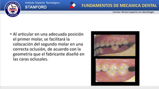 • Al articular en una adecuada posición
el primer molar, se facilitará la
colocación del segundo molar en una
correcta oclusión, de acuerdo con la
geometría que el fabricante diseñó en
las caras oclusales.
 