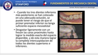 • - Cuando los tres dientes inferiores
más posteriores se han colocado
en una adecuada oclusión, se
puede tener el riesgo de que el
primer premolar inferior no tenga
suficiente espacio mesiodistal
• Desgastar ligeramente con un
fresón las caras proximales hasta
lograr la medida exacta del espacio
disponible, y de esta manera lograr
la completa intercuspidacion de
todos los dientes superiores e
inferiores.
 