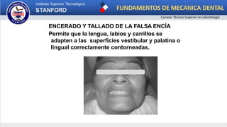 ENCERADO Y TALLADO DE LA FALSA ENCÍA
Permite que la lengua, labios y carrillos se
adapten a las superficies vestibular y palatina o
lingual correctamente contorneadas.
 