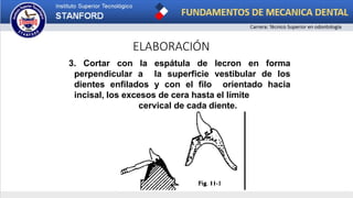 ELABORACIÓN
3. Cortar con la espátula de lecron en forma
perpendicular a la superficie vestibular de los
dientes enfilados y con el filo orientado hacia
incisal, los excesos de cera hasta el límite
cervical de cada diente.
 