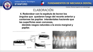 ELABORACIÓN
4. Redondear con la espátula de lecron los
ángulos que quedaron luego del recorte anterior y
contornee las papilas interdentales haciendo que
las superficies sean convexas,
dándole rasgos naturales a la encía marginal y
papilar.
 