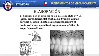 ELABORACIÓN
6. Realizar con el extremo romo dela espátula n°7 un
ligero surco horizontal continuo a 4mm de la línea
cervical de cada diente que nos representará el
límite entre la encía adherida y mucosa móvil en la
superficie vestibular.
 