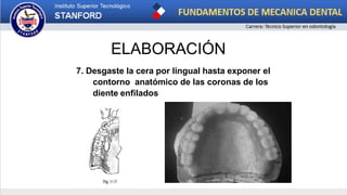 ELABORACIÓN
7. Desgaste la cera por lingual hasta exponer el
contorno anatómico de las coronas de los
diente enfilados
 