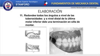 ELABORACIÓN
11. Redondee todos los ángulos a nivel de las
tuberosidades y a nivel distal de la última
molar inferior dele una terminación en silla de
montar.
 