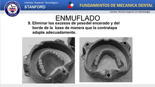 ENMUFLADO
9. Eliminar los excesos de yesodel encerado y del
borde de la base de manera que la contratapa
adapte adecuadamente.
 