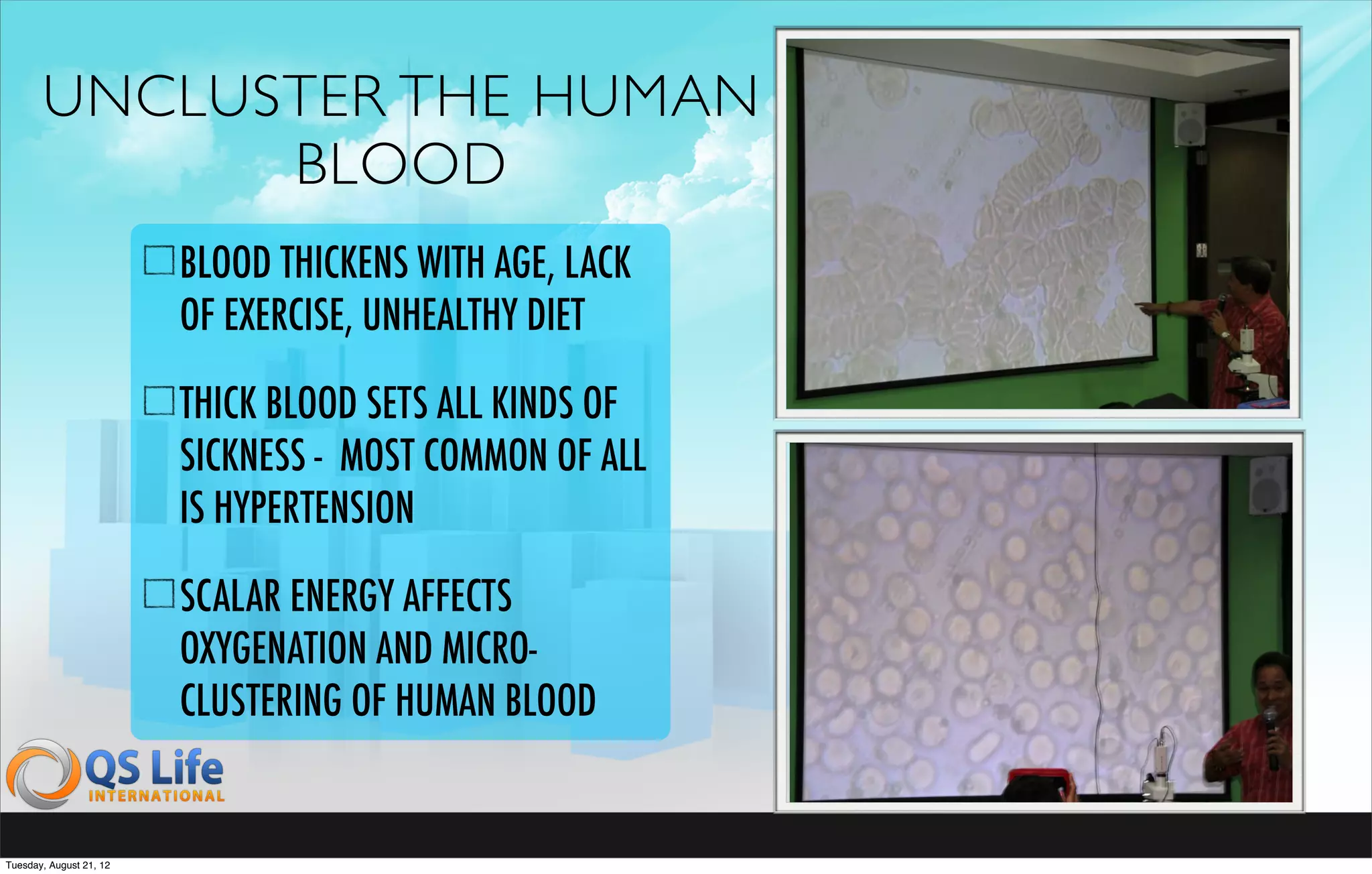 UNCLUSTER THE HUMAN
             BLOOD
                         BLOOD THICKENS WITH AGE, LACK
                         OF EXERCISE, UNHEALTHY DIET

                         THICK BLOOD SETS ALL KINDS OF
                         SICKNESS - MOST COMMON OF ALL
                         IS HYPERTENSION

                         SCALAR ENERGY AFFECTS
                         OXYGENATION AND MICRO-
                         CLUSTERING OF HUMAN BLOOD


Tuesday, August 21, 12
 