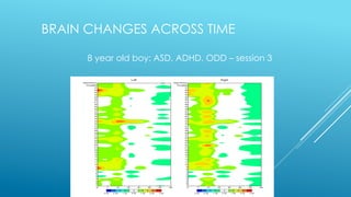8 year old boy: ASD, ADHD, ODD – session 3
BRAIN CHANGES ACROSS TIME
 