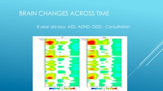 BRAIN CHANGES ACROSS TIME
8 year old boy: ASD, ADHD, ODD - Consultation
 