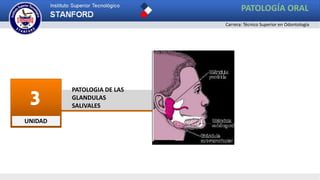 UNIDAD
3 PATOLOGIA DE LAS
GLANDULAS
SALIVALES
PATOLOGÍA ORAL
Carrera: Técnico Superior en Odontología
 