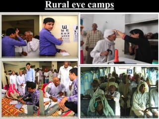 Rural eye camps
 