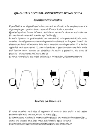 QUAD-HELIX DECESARI - INNOVAZIONE TECNOLOGICA
descrizione del dispositivo
Il quad-helix è un dispositivo ad azione meccanica utilizzato nella terapia ortodontica
di prima fase per espandere trasversalmente l'arcata dentaria superiore.
Questo dispositivo è essenzialmente costituito da una molla di norma realizzata con
filo a sezione circolare (0.9 m/m) in lega Cr-Co. (fig.1)
La molla è formata da quattro volute, due anteriori (a) e due posteriori (b); dal ponte
anteriore che collega trasversalmente le prime due volute (c); da due ponti laterali che
si estendono longitudinalmente dalle volute anteriori a quelle posteriori (d) e da due
appendici, anch'esse laterali (e), atte a distribuire la pressione esercitata dalla molla
(dall'interno verso l'esterno) sul complesso dei molari e premolari, allo scopo di
produrre l'allargamento dell'arcata. (fig.2)
La molla è stabilizzata alle bande, cementate ai primi molari, mediante saldatura
taratura del dispositivo
Il ponte anteriore costituisce il segmento di taratura della molla e può essere
facilmente plasmato con una pinza a tre punte.(fig.3)
La deformazione plastica del ponte anteriore provoca una rotazione localizzata(fig.4),
quindi una taratura della forza con la quale la molla agisce sui denti.
Il dispositivo deve agire simmetricamente col piano dell'arcata.(fig.5)
a a
b b
c
d d
e e
fig.1 fig.2
 