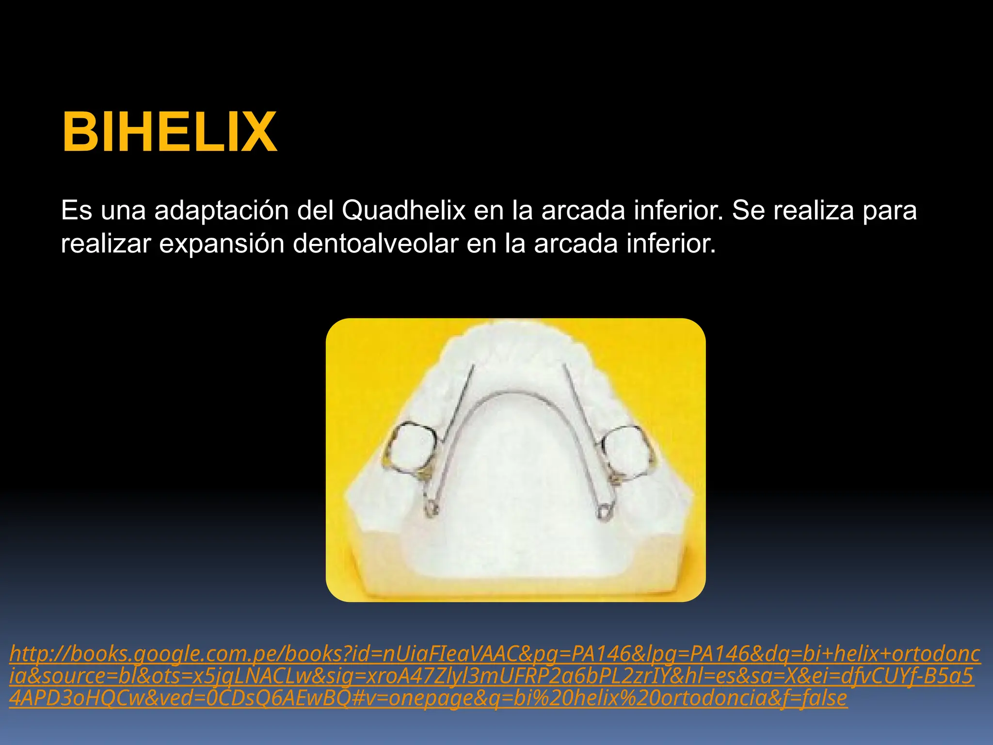 quad helix, caracteristicas, expansiones | PPTX