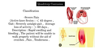Quadricep Contusion
Classification
-Severe Pain
(Active knee flexion : <45 degree ,
Gait : Severely antalgic gait , Average
loss of activity : > 60 days ,
Description : Rapid swelling and
bleeding , The patient will be unable to
walk properly without the aid of
crutches , Pain , Tenderness .
0 Quadriceps
Contusion
Blunt trauma to the thigh
INIcauses bleedingdttp
within the mmde
 