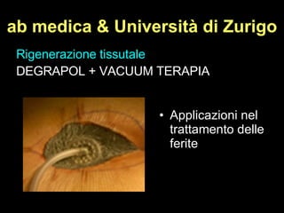 ab medica & Università di Zurigo Applicazioni nel trattamento delle ferite  Rigenerazione tissutale DEGRAPOL + VACUUM TERAPIA 