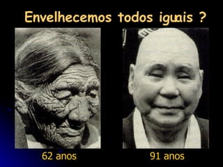 Envelhecemos todos iguais ? 62 anos 91 anos 