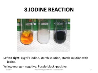 8.IODINE REACTION8.IODINE REACTION
Left to right: Lugol's iodine, starch solution, starch solution with
iodine.
Yellow-orange - negative. Purple-black -positive.
06/15/14 Biochemistry For Medics- Lecture notes 37
 