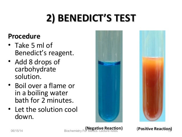 Benedict S Solution Color Chart