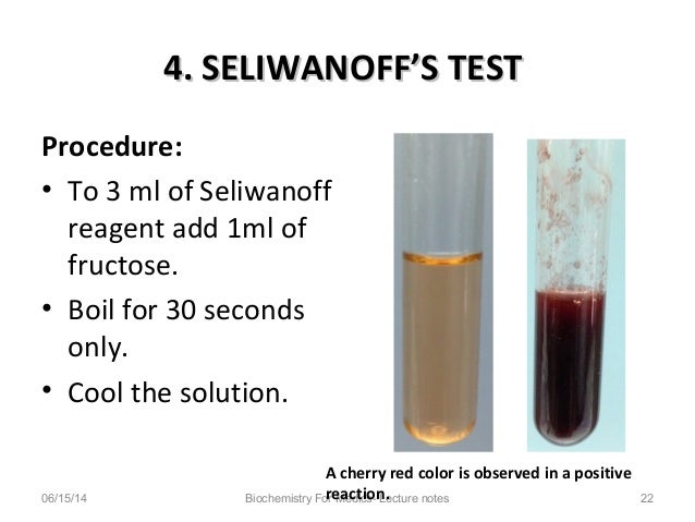 qualitative tests for carbohydrates would you expect fructose or glucose to form a red color rapidly with seliwanoff s reagent