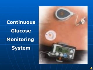 Continuous Glucose Monitoring  System 