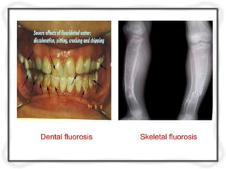unit- 1     Quality and Quantity Standards for Drinking Water.pptx