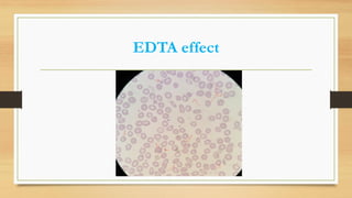 EDTA effect
 