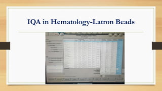 IQA in Hematology-Latron Beads
 