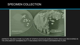 SPECIMEN COLLECTION
ASPIRATE YIELDED A PURE CULTURE OF STAPHYLOCOCCUS AUREUS.STAPH WAS ALSO RECOVERED IN
THE SPECIMEN BY SWABBING BUT IT WAS MIXED WITH OTHER CONTAMINATING FLORA
 