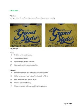 Quality control management  in apparel industries.