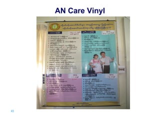 AN Care Vinyl

45 |

 