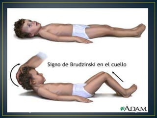 ClínicaViral:Quadros subagudosFebreCefaleia leve a moderadaFotofobiaEscassa rigidez nucaBacterianas:Quadros maior manifestação e rápida evoluçãoFebre elevadaCefaleia intensafotofobiaRigidez nuca marcadaKernig e brudzinski positivosNáuseas e vômitosopstótonosSudoreseProstraçãoAlguns casos : afeta pares cranianos: IV-VI-VIIAlteração nível de consciênciaConvulsõesMeningococcemia: Rash maculo eritematoso disseminado ou hemorrágico