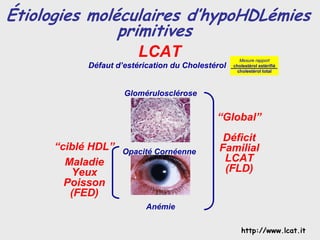 Étiologies moléculaires d’hypoHDLémies
               primitives
                         LCAT                        Mesure rapport
            Défaut d’estérication du Cholestérol   cholestérol estérifié
                                                    cholestérol total




                     Glomérulosclérose


                                             “Global”
                                               Déficit
      “ciblé HDL”   Opacité Cornéenne         Familial
        Maladie                                LCAT
         Yeux                                  (FLD)
        Poisson
         (FED)
                           Anémie

                                                      http://www.lcat.it
 